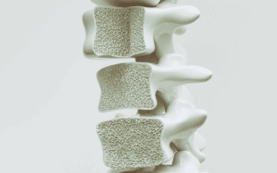 Osteo­po­rose